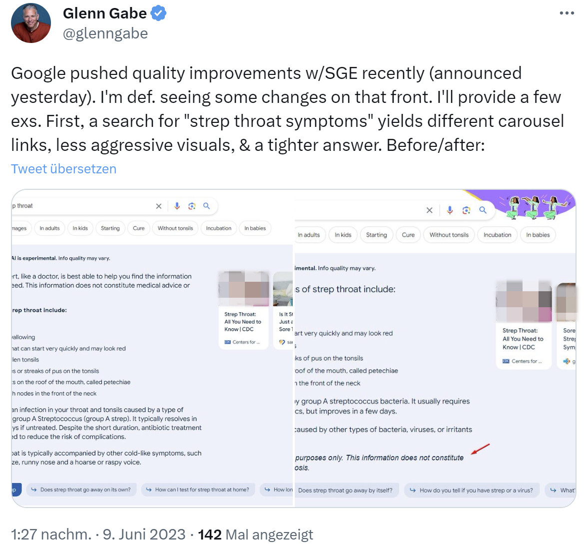 Google SGE: bessere Antwortzeit für Suche nach 'Halsentzündung'