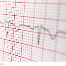 Google: 'Niemand bei uns zählt die Wörter auf einer Webseite'